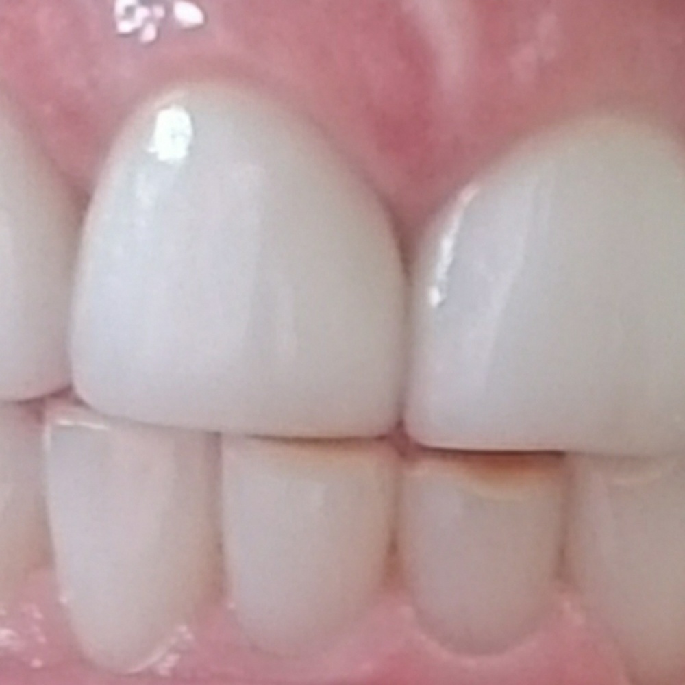 AP24 toothpaste - Picture 3 of 3